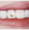 Tooth jewelry Star Sapphire