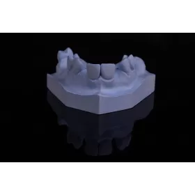 Plaster Interdur Type III, 1 kg