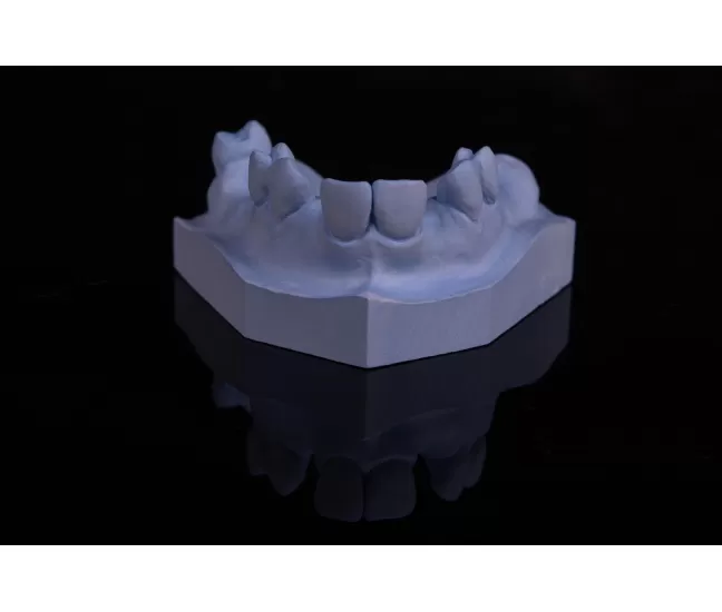 Plaster Interdur Type III, 1 kg