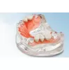 Thermoplastic acrylic DENTIFLEX