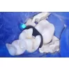 Sectional matrices LumiContrast, Premolar, 5 mm, 70 pcs.