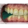 Articulating paper Arti-Ceram 100 µ green horseshoe, 50 pcs.