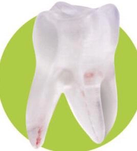 Study Model 2633-101-PCL