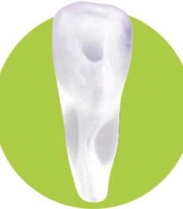 Study Model 2111-1A2-PCL