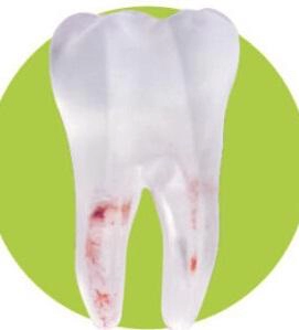 Study Model 3623-101-PCL