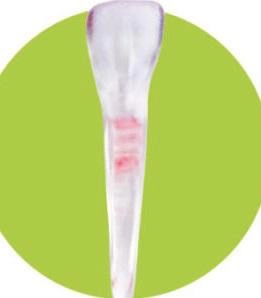 Study Model 3111-101-PCL